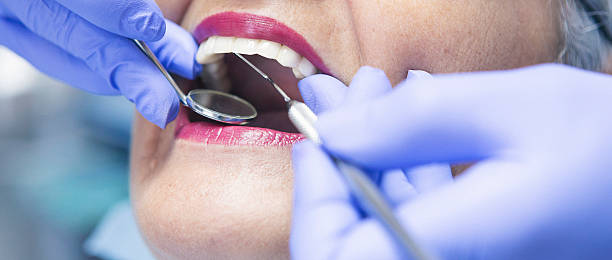 Best Emergency Tooth Extraction in Wallington, NJ